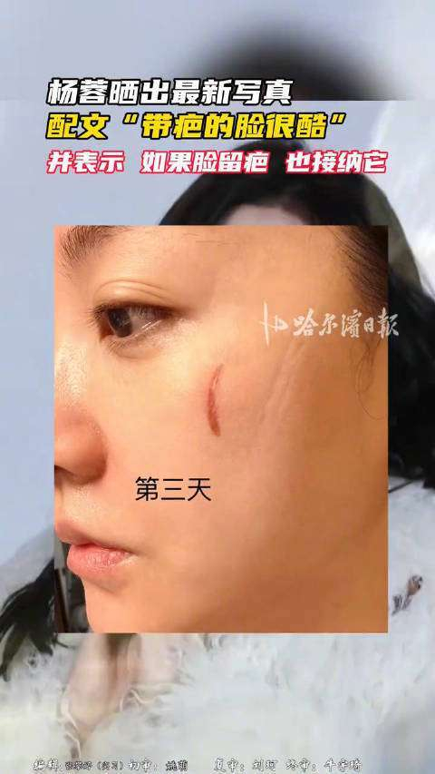  如今的杨蓉，活得越来越像她自己。前几天，朱一龙过生日，她照例送上了祝福。两人已经有着12年的友情，这段时间早已成为娱乐圈里的佳话。他们不炒作、不营销，而是默默地在自己的事业中深耕，生活也过得坦坦荡荡。或许正是这种松弛和从容，让她在47岁时散发出比年轻时更耀眼的光芒。毕竟，和生活中的不完美和解，才是一种真正的超酷能力。而相较于那些完美无瑕的女神，人们更爱她这样一个带着疤痕，依然能够笑得灿烂的真实女孩。